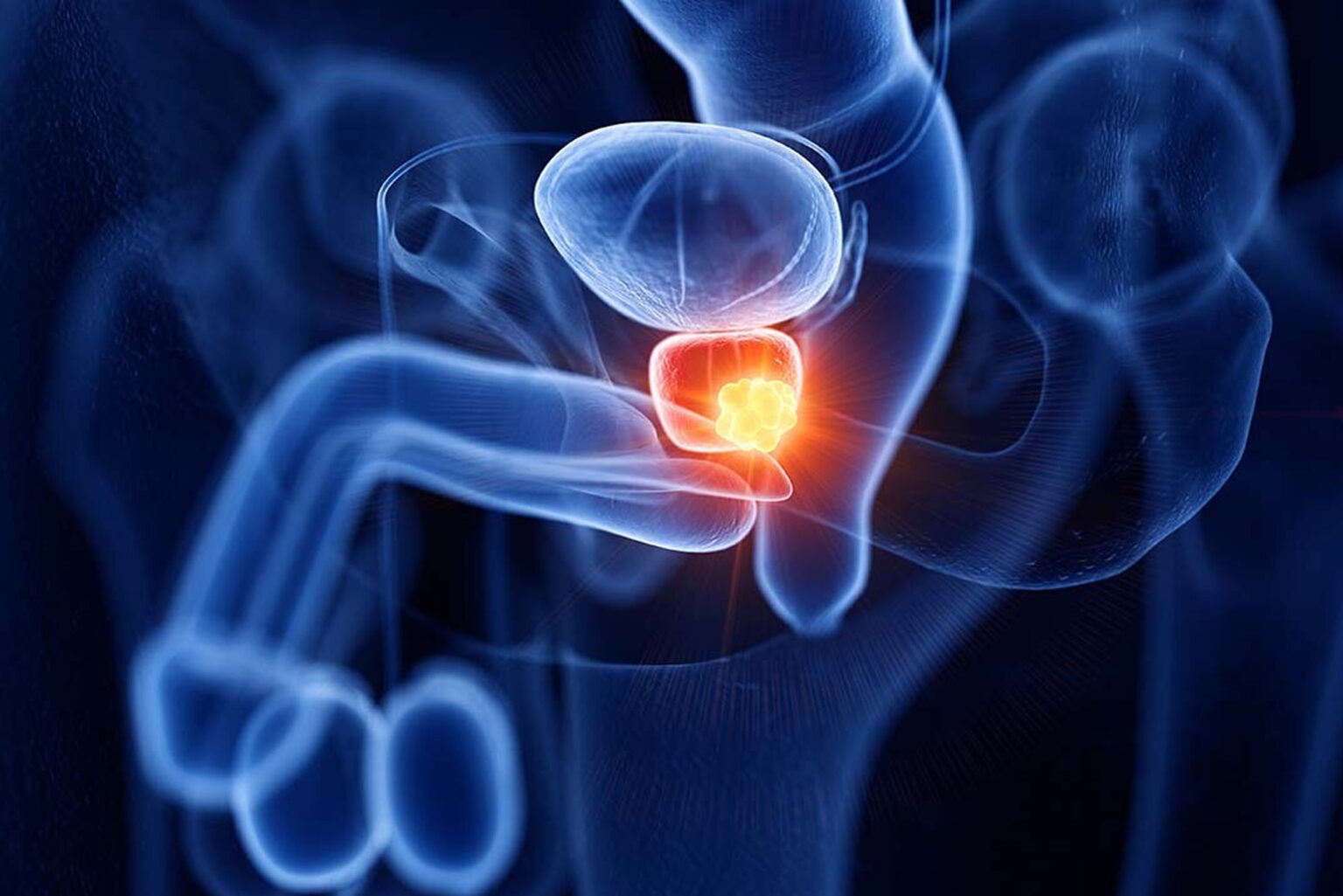 Próstata / Hiperplasia Prostática Benigna - Dr. Felipe Delgado